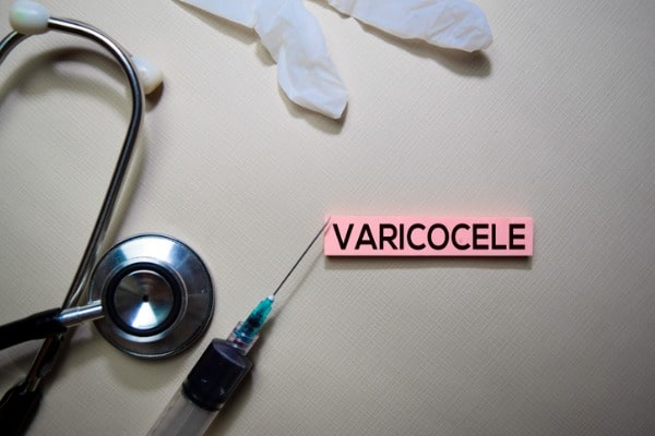 varicocele